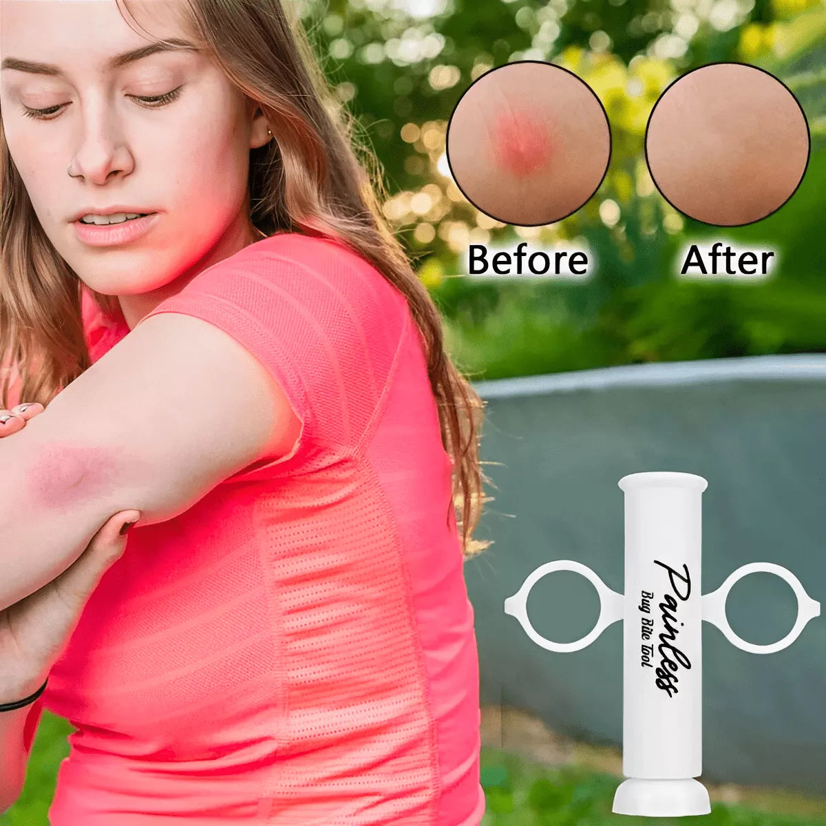 Outil Anti-Piqûres pour Soulagement Instantané – Portable et Sans Produits Chimiques