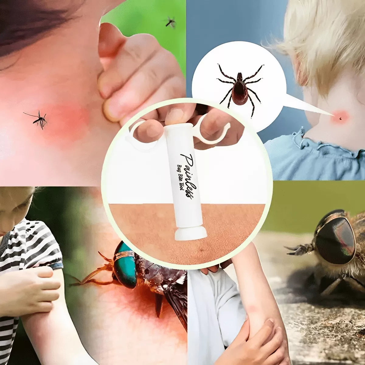 Outil Anti-Piqûres pour Soulagement Instantané – Portable et Sans Produits Chimiques