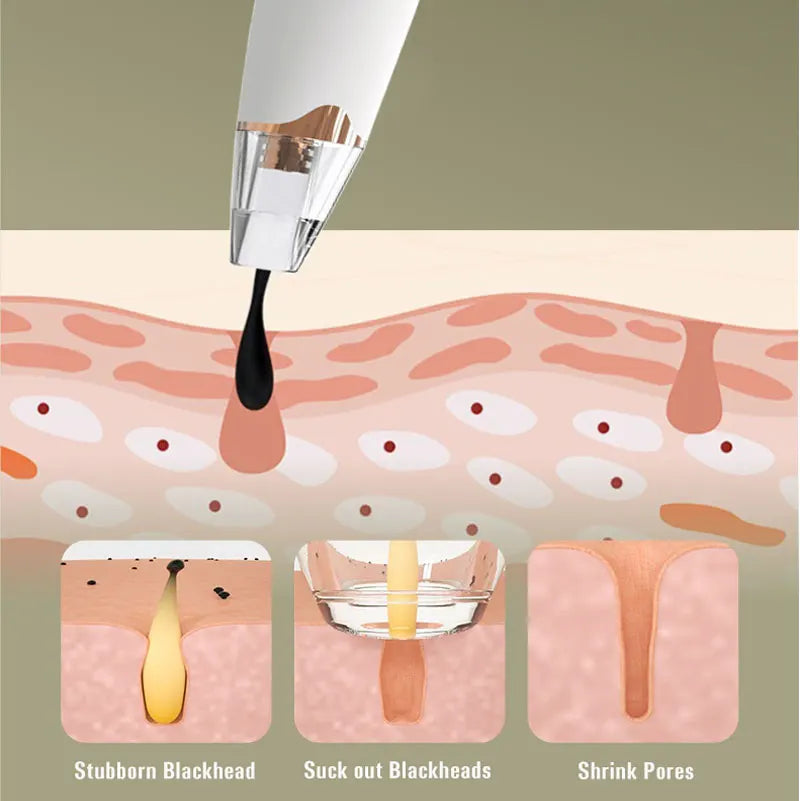 Blackhead Remover Vacuum Pore Cleaner Electric Beauty Skin Care