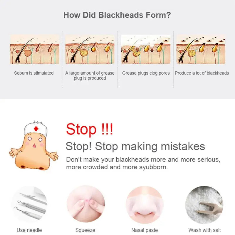 Blackhead Remover Vacuum Pore Cleaner Electric Beauty Skin Care