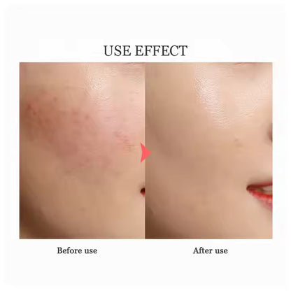 Masque Visage Coréen Multi-Réparateur à la Bave d’Escargot et à l’Acide Hyaluronique – Répare, Hydrate et Illumine